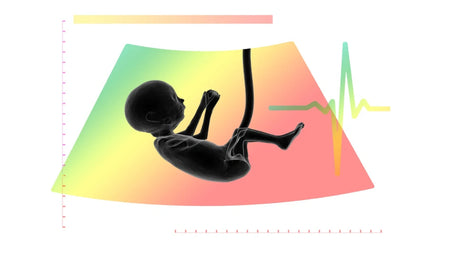 baby-heart-gender-prediction