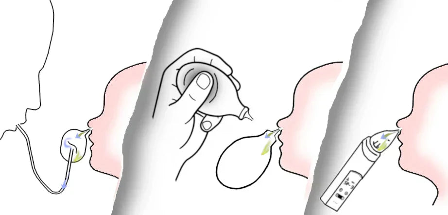 Manual nasal aspirators: types, pros and cons