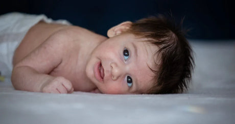 Mild mottling on a swaddled newborn