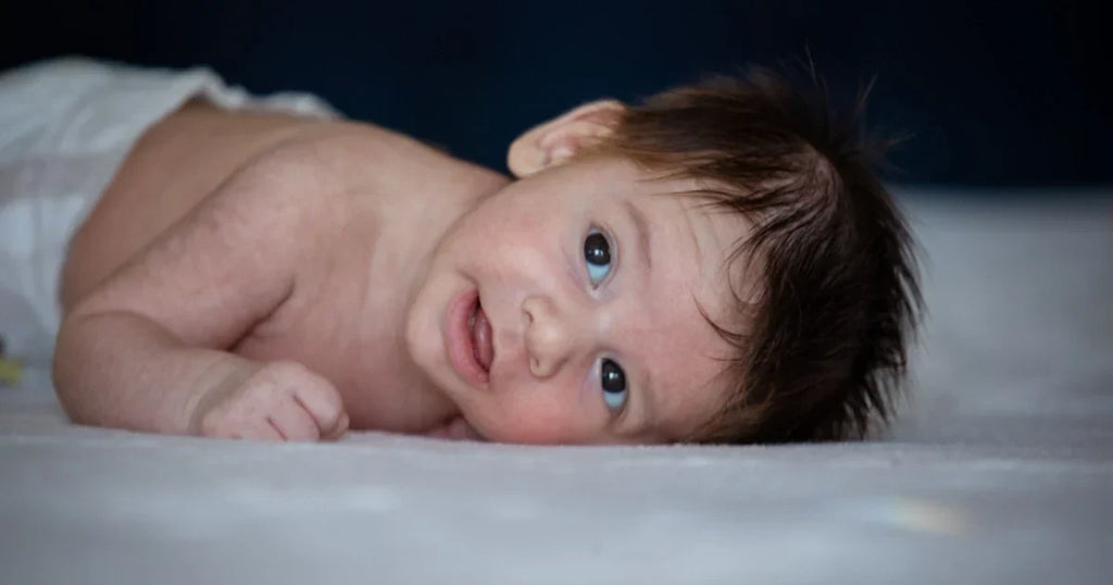 Mild mottling on a swaddled newborn